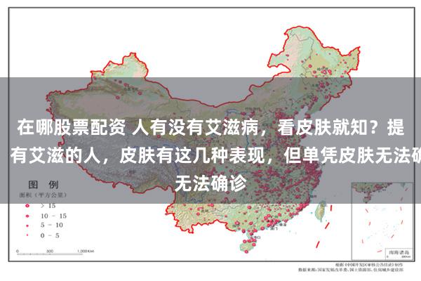 在哪股票配资 人有没有艾滋病，看皮肤就知？提醒：有艾滋的人，皮肤有这几种表现，但单凭皮肤无法确诊